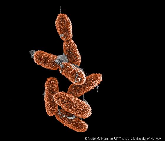 Methylobacter jord Svalbard-CMYK_new.jpg bacteria